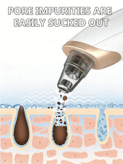 Blackhead Remover Vacuum Pore Deep Cleansing Device