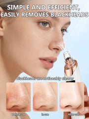 Blackhead Remover Vacuum Pore Deep Cleansing Device