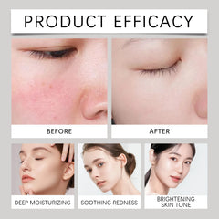 147 Korean Relief Cream Anti-Blemish Moisturizing Skincare