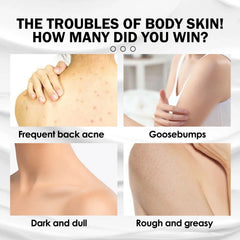 Moisturizing Keratosis Pilaris Repair & Smoothing Cream