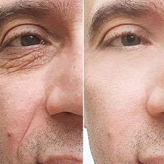 Retinol Eye Cream for Men Anti-Wrinkle Dark Circle Care