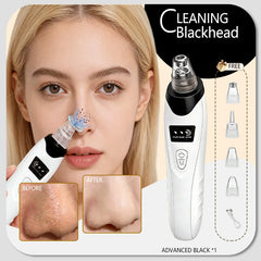 Blackhead Remover Vacuum Pore Deep Cleansing Device