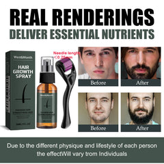 Men’s Beard Growth Spray Kit with Micro Roller