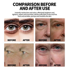 Retinol Eye Cream for Men Anti-Wrinkle Dark Circle Care