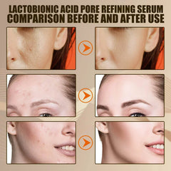 Pore Shrink Oil Control Anti-Acne Facial Serum