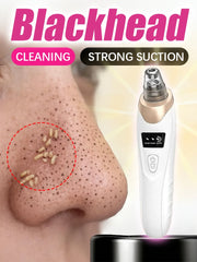Blackhead Remover Vacuum Pore Deep Cleansing Device