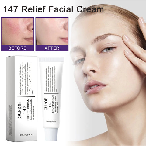 147 Korean Relief Cream Anti-Blemish Moisturizing Skincare